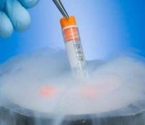 �Թ�Ӥ���ķ�չ����״